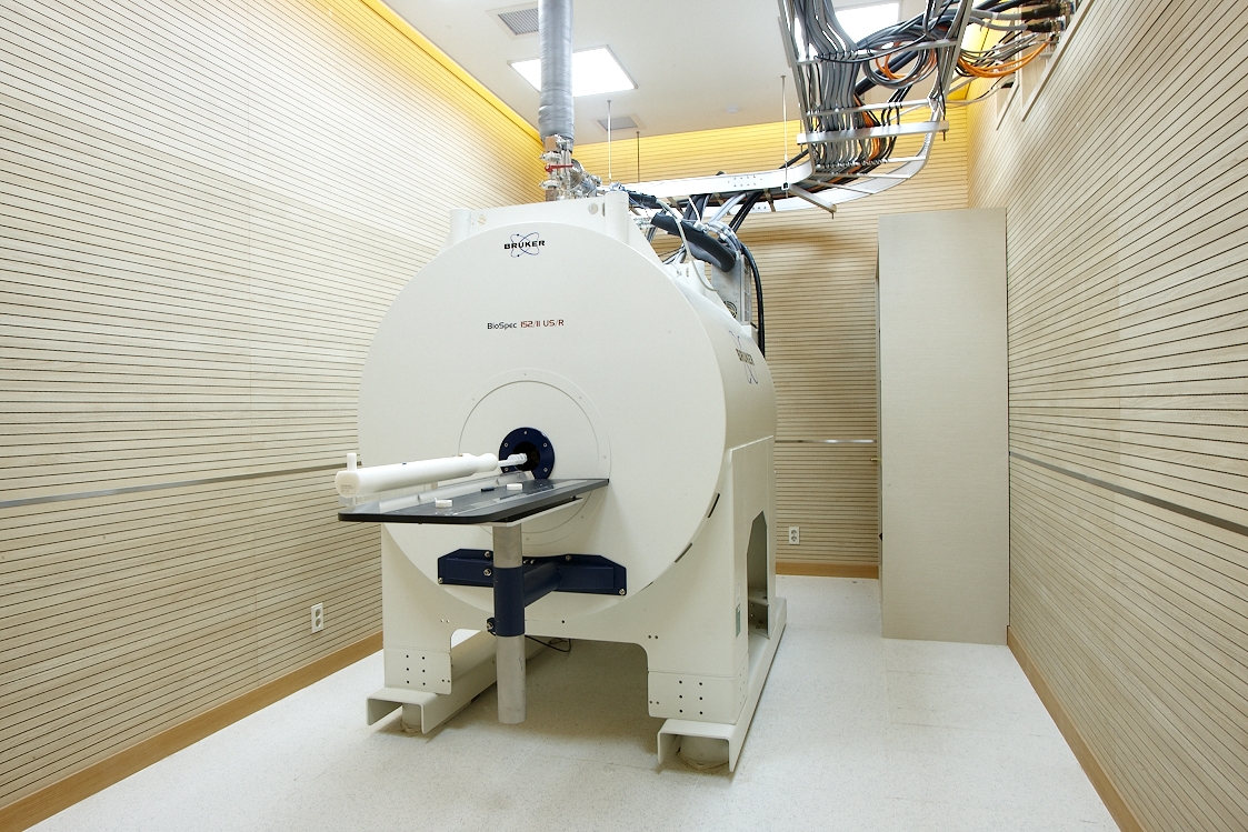 15.2T MRI